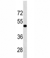TGFBR1 antibody western blot analysis in human HL-60 lysate. Predicted molecular weight: ~55 kDa.