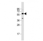 TGFBR1 antibody western blot analysis in human A431 cell lysate. Predicted molecular weight: ~55 kDa.