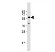 TGFBR1 antibody western blot analysis in human A431 cell lysate. Predicted molecular weight: ~55 kDa.