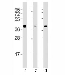 Western blot testing of ERCC1 antibody at 1:2000 dilution. Lane 1: A549 lysate; 2: HeLa lysate; 3: T47D lysate