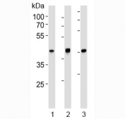 TBP antibody western blot analysis in (1) human HeLa, (2) (h) HepG2, (3) mouse NIH3T3 lysate. Expected molecular weight: 35-43 kDa.