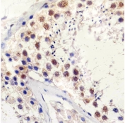 IHC testing of FFPE human testis tissue with TBP antibody at 1:25 dilution. HIER: pH6 citrate buffer.