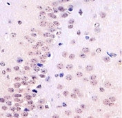 IHC testing of FFPE mouse brain tissue with TBP antibody at 1:25 dilution. HIER: pH6 citrate buffer.