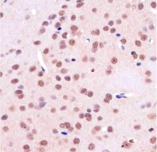 IHC testing of FFPE rat brain tissue with TBP antibody at 1:25 dilution. HIER: pH6 citrate buffer.