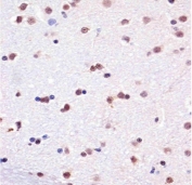 IHC testing of FFPE monkey brain tissue with TBP antibody at 1:25 dilution. HIER: pH6 citrate buffer.