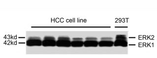 Western blot analysis of extracts from HCC cell line and 293T cells