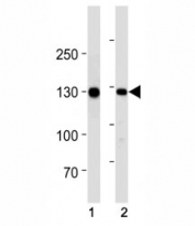CDH1 antibody western blot analysis in (1) human WiDr cell line and (2) mouse stomach tissue lysate. Expected molecular weight: 135 kDa (precursor), 80-120 kDa (mature, depending on gylcosylation level).