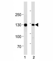 CDH1 antibody western blot analysis in (1) human WiDr cell line and (2) mouse stomach tissue lysate.