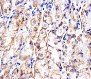 Immunohistochemical analysis of paraffin-embedded human stomach using CDH1 antibody at 1:25 dilution.