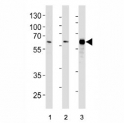 HDAC1 antibody western blot analysis in (1) HeLa, (2) WiDr, and (3) Jurkat lysate. Predicted molecular weight 55~60 kDa