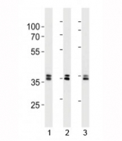 UCH37 antibody western blot analysis in 293, HeLa, 293T lysate. Predicted molecular weight ~37 kDa (4 isoforms).