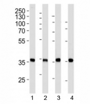 Nucleophosmin antibody western blot analysis in 1) HeLa, 2) Jurkat, 3) MCF-7, and 4) mouse NIH3T3 lysate. Expected/observed molecular weight: ~38kDa.
