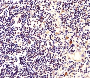 Immunohistochemical analysis of paraffin-embedded human thymus using Nucleophosmin antibody at 1:25 dilution.~