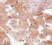 IHC analysis of FFPE human skeletal muscle section using SDHA antibody; Ab was diluted at 1:25.