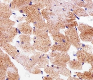 IHC analysis of FFPE human skeletal muscle section using SDHA antibody; Ab was diluted at 1:25.