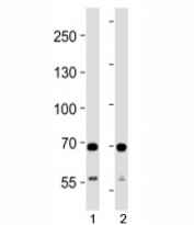 SDHA antibody western blot analysis in 1) human HeLa and 2) mouse C2C12 lysate. Predicted molecular weight ~72 kDa.