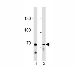TICAM1 antibody western blot analysis in (1) Ramos cell line and (2) mouse liver tissue lysate.