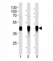 HLA-G antibody western blot analysis in (1) A549, (2) Ramos, (3) MDA-MB-231 lysate. Predicted molecular weight ~40 kDa.