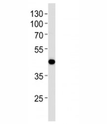 Western blot analysis of lysate from NCI-H292 cell line using AIM2 antibody at 1:1000. Predicted molecular weight 40-45 kDa.