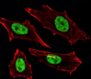 Fluorescent image of HeLa cells stained with MGMT antibody at 1:25 dilution. An Alexa Fluor 488-conjugated goat anti-mouse lgG was used as the secondary Ab (green). Cytoplasmic actin was counterstained with Alexa Fluor 555 conjugated with Phalloidin (red).