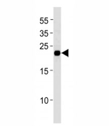 MGMT antibody western blot analysis in MCF-7 lysate