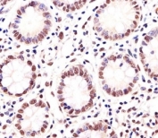Immunohistochemical analysis of paraffin-embedded human small intestine using MGMT antibody at 1:25 dilution.