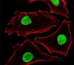 Fluorescent image of HeLa cells stained with SUMO-2 antibody at 1:25 dilution. An Alexa Fluor 488-conjugated goat anti-mouse lgG was used as the secondary Ab (green). Cytoplasmic actin was counterstained with Alexa Fluor 555 conjugated with Phalloidin (red).~