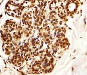 Immunohistochemical analysis of paraffin-embedded human breast using PIN1 antibody at 1:25 dilution.