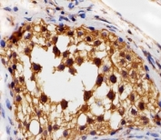 Immunohistochemical analysis of paraffin-embedded human testis section using VEGFR3 antibody at 1:25 dilution.