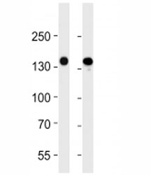 VEGFR3 antibody western blot analysis in 293 and A549 lysate. Predicted molecular weight ~145 kDa.
