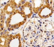 Immunohistochemical analysis of paraffin-embedded human kidney section using VEGFR3 antibody at 1:25 dilution.