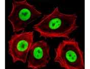 Fluorescent image of MCF-7 cells stained with Cdk4 antibody. Ab was diluted at 1:25 dilution. An Alexa Fluor 488-conjugated goat anti-rabbit lgG was used as the secondary Ab (green). Cytoplasmic actin was counterstained with Alexa Fluor 555 conjugated with Phalloidin (red).