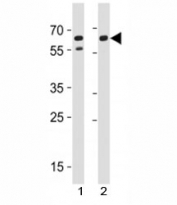 CD46 antibody western blot analysis with human 1) A549 and 2) HeLa cell lysate.
