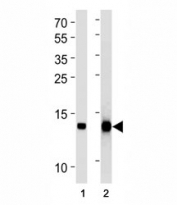 FABP4 antibody western blot analysis in (1) human placenta and (2) mouse 3T3-L1 lysate. Predicted molecular weight ~15 kDa.