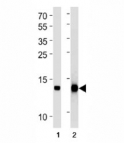 FABP4 antibody western blot analysis in (1) human placenta and (2) mouse 3T3-L1 lysate. Predicted molecular weight ~15 kDa.