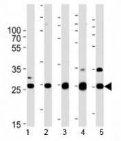 Sdhb antibody western blot analysis in human 1) HeLa, 2) HL-60, 3) mouse heart, 4) rat heart, and 5) zebrafish heart tissue lysate. Predicted molecular weight 25-32 kDa.