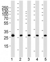 Western blot analysis of lysate from 1) 293, 2) MCF-7, 3) HepG2, 4) mouse NIH3T3 cell line and 5) rat liver tissue using PHB1 antibody at 1:1000. Predicted molecular weight ~29 kDa.