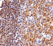 Immunohistochemical analysis of paraffin-embedded human tonsil section using NFKB1 antibody at 1:25 dilution.