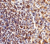 Immunohistochemical analysis of paraffin-embedded human spleen using NFKB1 antibody at 1:25 dilution.