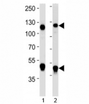Western blot analysis of lysate from 1) Daudi and 2) Jurkat cell line using NFKB1 antibody at 1:1000. Expected molecular weight: 50 kDa / 105 kDa.