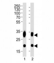 Western blot analysis of lysate from 1) Daudi and 2) Raji cell line using CD74 antibody at 1:1000.
