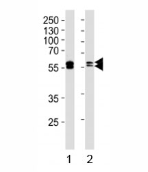 Western blot analysis of lysate from 1) A431 and 2) Raji cell line using LYN antibody. Predicted molecular weight: 56/58 kDa (isoforms 1/2).