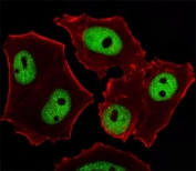 Fluorescent image of MCF-7 cells stained with GATA3 antibody at 1:25 dilution. An Alexa Fluor 488-conjugated goat anti-mouse lgG was used as the secondary Ab (green). Cytoplasmic actin was counterstained with Alexa Fluor 555 conjugated with Phalloidin (red).