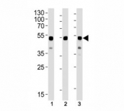 Western blot analysis of lysate from (1) CEM, (2) HL-60 and (3) SH-SY5Y cell lines using GATA3 antibody at 1:1000. Predicted molecular weight: 50 kDa