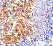 Immunohistochemical analysis of paraffin-embedded rat spleen using FYN antibody at 1:25 dilution.