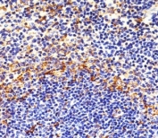 Immunohistochemical analysis of paraffin-embedded mouse spleen using FYN antibody at 1:25 dilution.