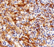 Immunohistochemical analysis of paraffin-embedded human tonsil using FYN antibody at 1:25 dilution.