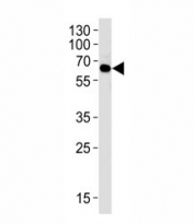 Western blot analysis of lysate from 293 cell line using FYN antibody at 1:1000. Predicted molecular weight: ~59 kDa.
