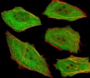 Fluorescent image of U251 cells stained with VCP antibody at 1:25. An Alexa Fluor 488-conjugated goat anti-mouse lgG was used as the secondary Ab (green). Cytoplasmic actin was counterstained with Alexa Fluor 555 conjugated with Phalloidin (red).