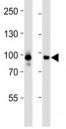 Western blot analysis of lysate from CEM, HeLa cell line (left to right) using STAT3 antibody at 1:1000 for each lane.